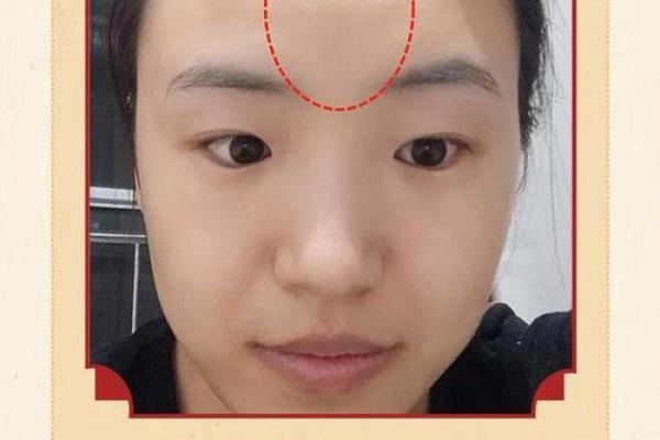 屁股上的痣暗示着什么，如何解读这些痣相