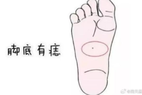 屁股上的痣暗示着什么，如何解读这些痣相