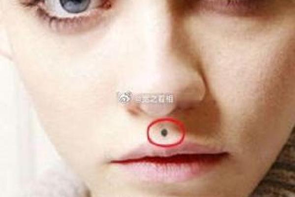 痣相与子嗣：命理中的隐性因素