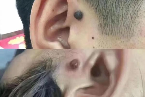 眼部痣相学：不同位置的痣暗示着不同性格特征