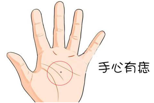 手背痣相解析：如何从手背痣的位置看命运与性格
