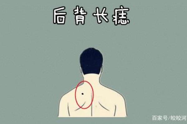 探索男性痣相与身体状况的内在联系
