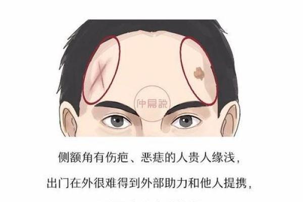 额骨面相与智商的关联：额头凸起与智慧的奥秘