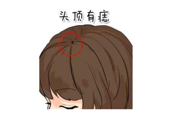 头顶痣相：如何通过它了解自己的生活运势