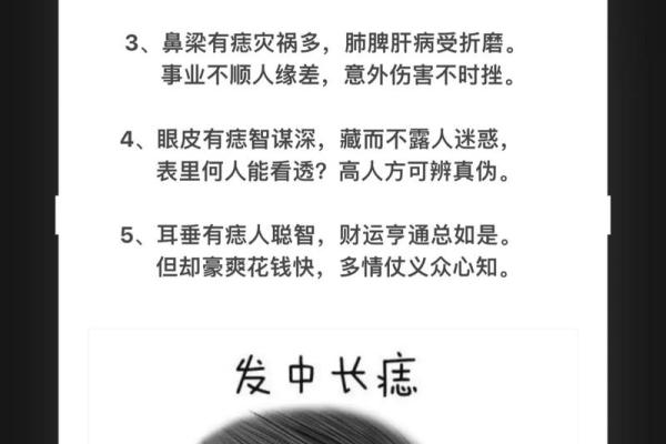 如何通过痣相辨别左右两侧的不同含义