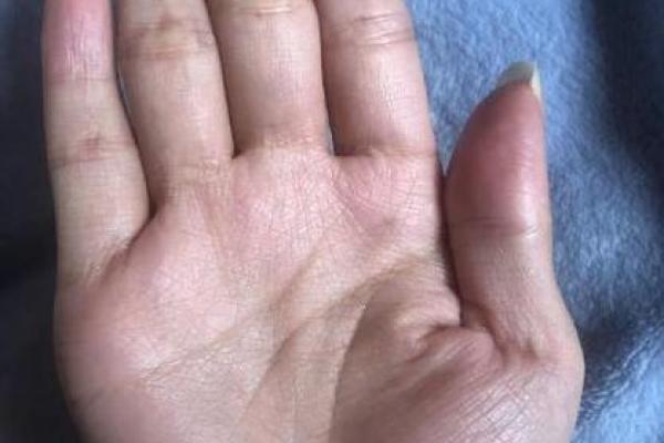 手相中的爪字纹解析：揭示性格与命运的秘密