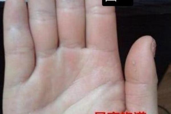 手指粗的人生运势：从手相看性格与财富