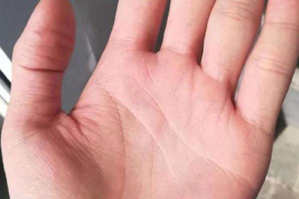 手相锁链的神秘含义与未来暗示解析