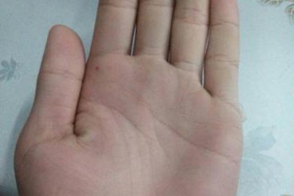 手相手术线解析：揭示你人生的关键转折点