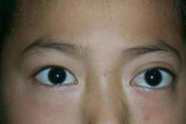 家暴面相与心理分析：如何通过面部特征识别潜在风险