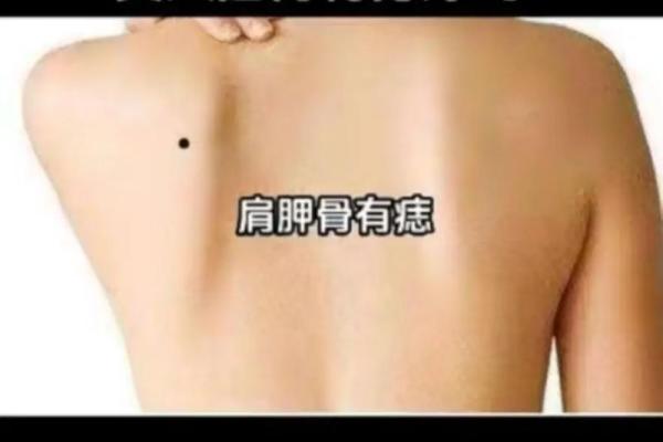 痣相能决定你的人生吗