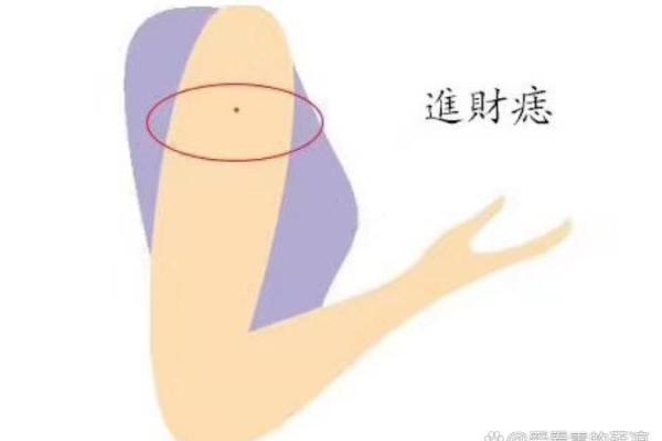 胳膊痣相的不同位置及其意义