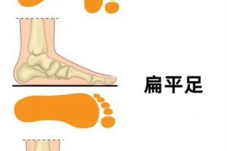 什么脚型代表富贵命运的象征？