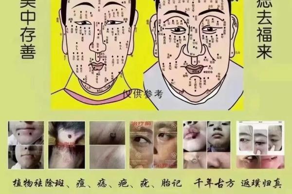 痣相与命运：解读中国传统痣相学的奥秘