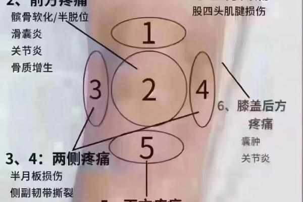 膝盖处的痣与命运：解析不同位置的含义