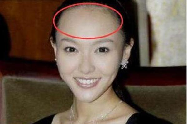 额骨面相揭示人生方向：额头宽窄与人生抉择