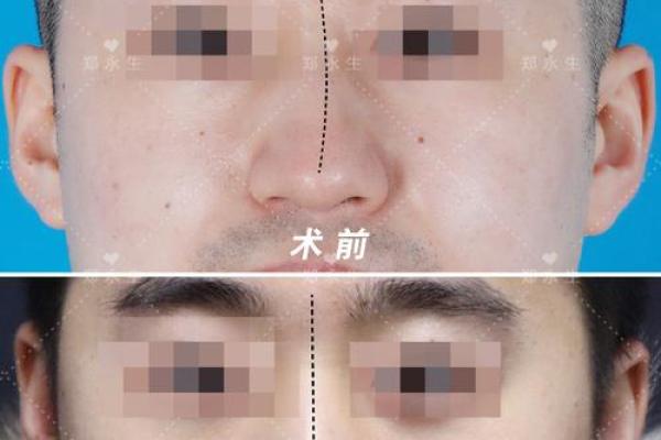 鼻子歪影响面相美观？了解它在命理中的含义