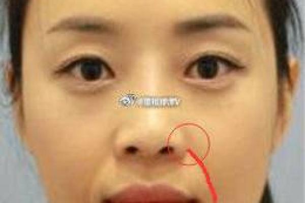 女士痣相与性格的关系：痣的位置揭示内心世界