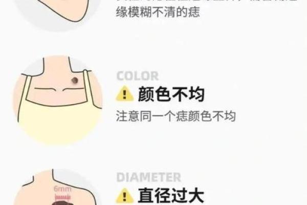 痣相学中的水险痣，揭示生命中的潜在危险