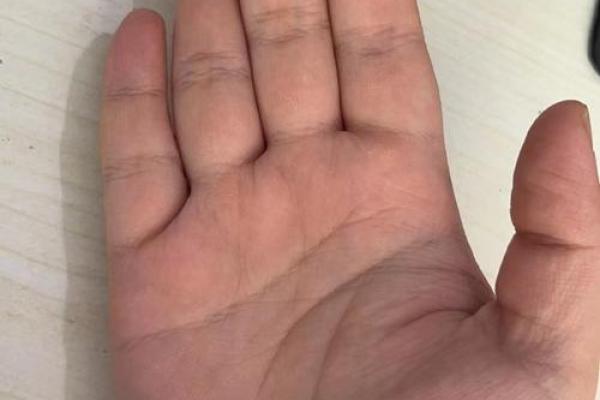 探秘手相锁链纹：它是否预示着你的命运转折