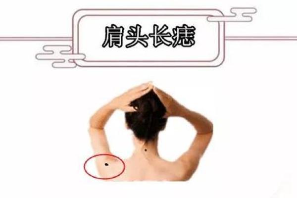 通过胳膊痣相分析个性特征与运势