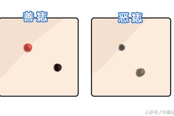 膝盖上的独特印记：女人膝盖痣的神奇功效