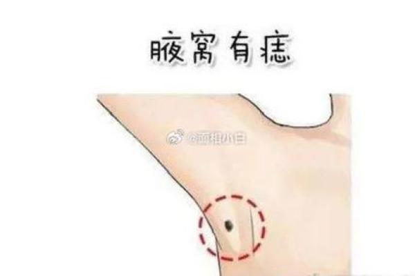 一颗痣改变命运？揭秘男子胳膊痣的神奇传说