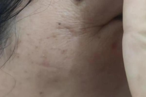左边痣的神秘魅力