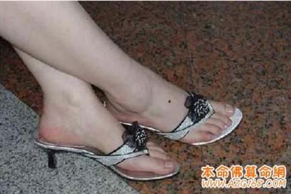 脚脖痣：揭秘你的健康和财运状况