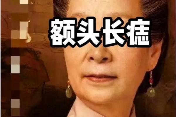 丧妻痣相探秘：揭秘命运中的不幸预兆，你中招了吗？