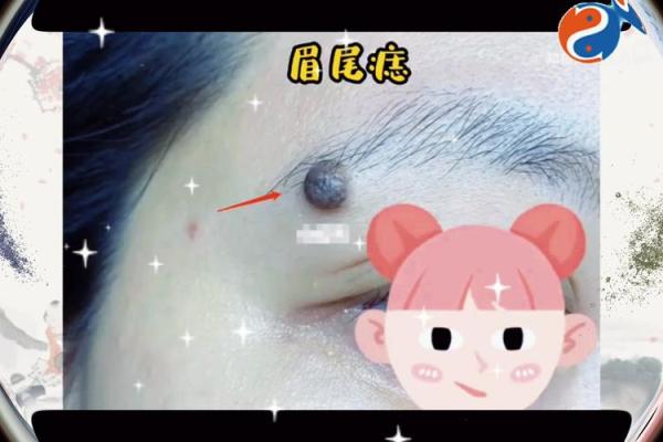 痣相之谜：揭秘如何醉死在枕边