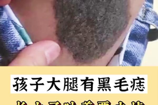 一痣定终身，大腿根部痣的秘密