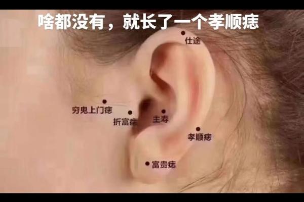 面痣佳人：揭秘相脸痣如何成就绝世容颜