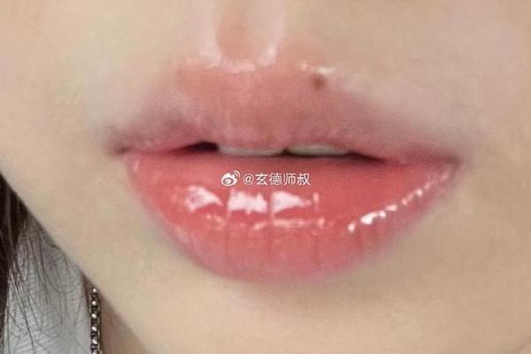 嘴唇有疤的面相运势揭秘：揭秘疤痕背后的命运密码