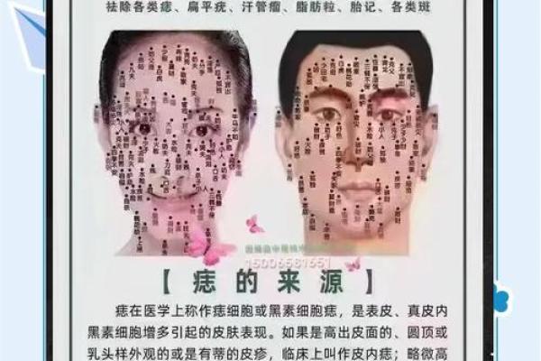 知己知彼，腿痣相教你读懂命运