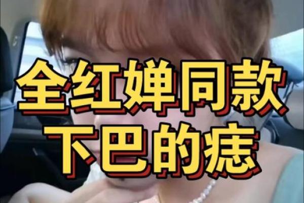 风水大师揭秘：下巴上的痣决定命运