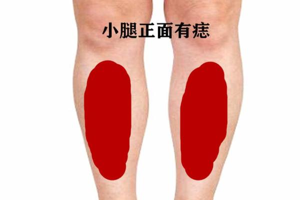 腿部风情：揭秘小腿内侧痣的神秘面纱
