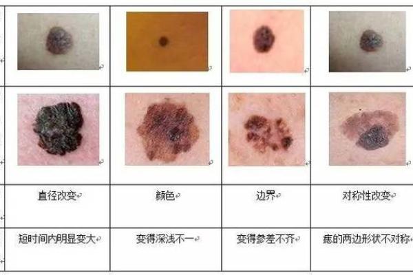 痣相解读：女人脸上的痣，透露出怎样的命运轨迹？