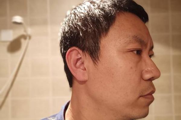 后发际线之谜：揭秘面相中的长寿密码