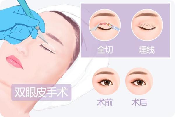 割双眼皮真的能改变面相？揭秘双眼皮整形背后的神奇魔力