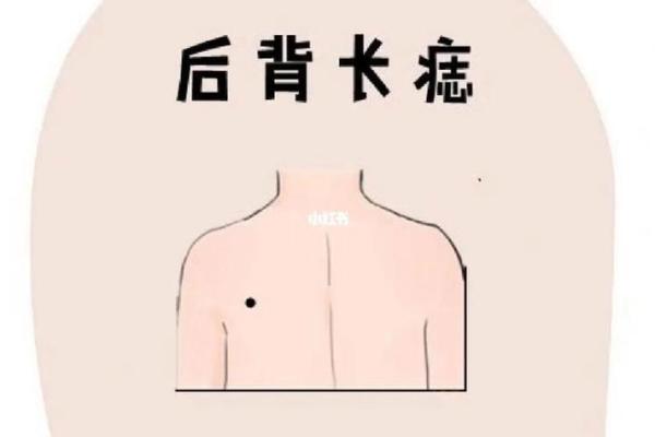男人左后颈痣：揭秘命运之痣的魅力所在