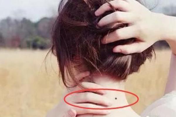 颈上神秘痣，是你的福星吗？