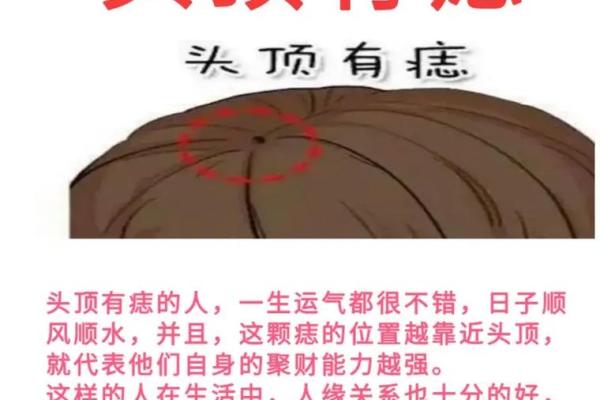 痣相大揭秘：哪些痣让你的人生更加精彩？