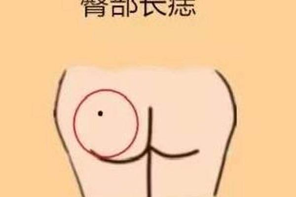 神秘痣相：麻衣屁股上的秘密符号