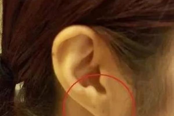 美丽解码：女人耳相痣的个性解析