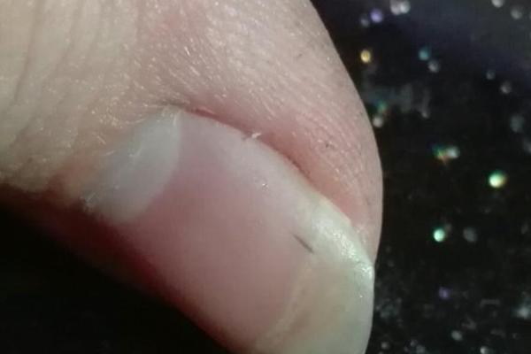 指甲下的神秘痣：命运密码大揭秘