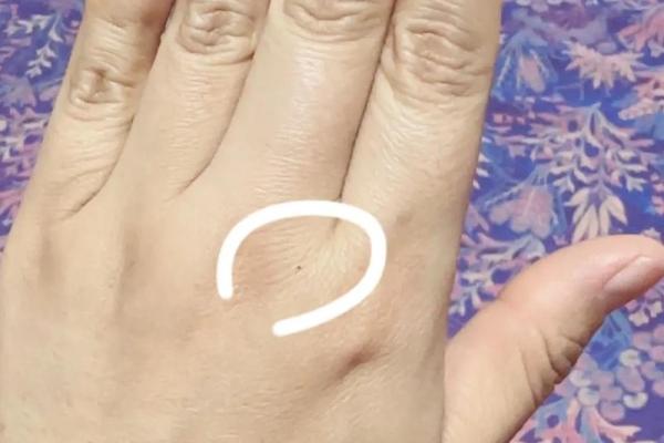 手背有痣竟是财运亨通？揭秘手相中的神秘预示