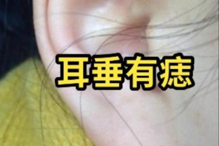 耳朵上的痣，男人的独特魅力标签