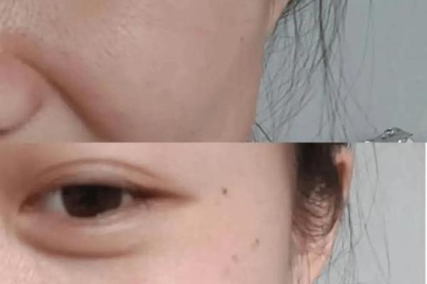 眉间八字纹悄悄出现？这些护肤秘诀让你重获光滑肌肤