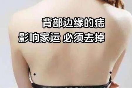 背部痣相解析：揭秘你的健康与财运